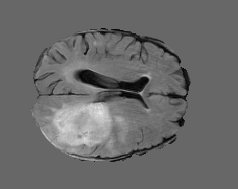 healthcare_thumb_brain
